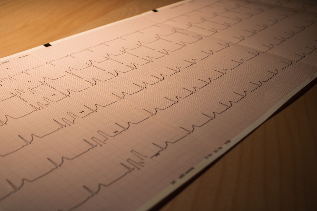 Cardiac Bypass